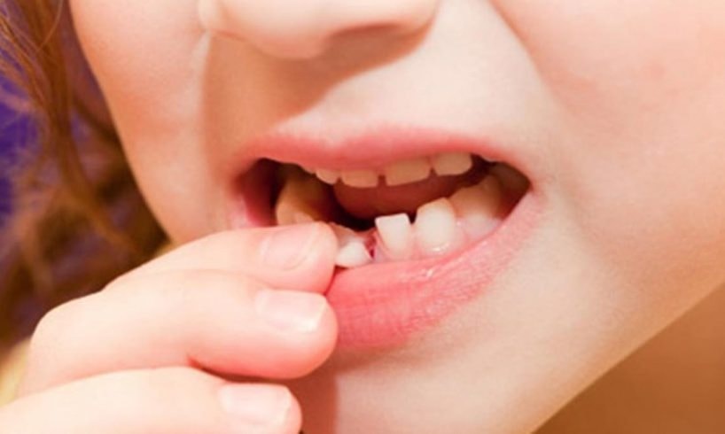 Mơ gãy răng báo điềm gì? Giải mã 15+ điềm báo chi tiết 2025