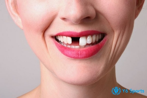 Phụ nữ mang thai mơ rụng răng phản ánh nỗi lo về khả năng chăm sóc em bé