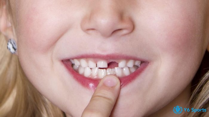 Hiểu rõ về mơ thấy rụng răng là điềm báo gì